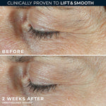 Close up of Roc Derm Correxion 20ml packaging