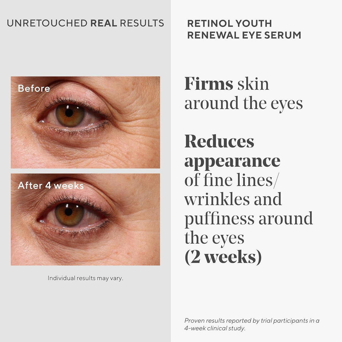 Murad Retinol Youth Renewal Eye Serum half fluid ounce green label bottle for fine lines