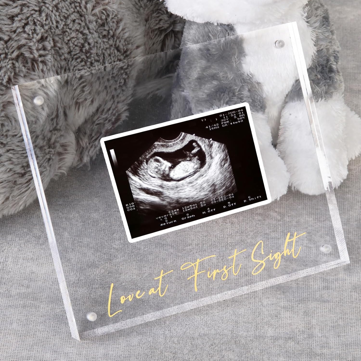 DEYIXUN Acrylic Ultrasound Picture Frame front view showcasing sonogram slot