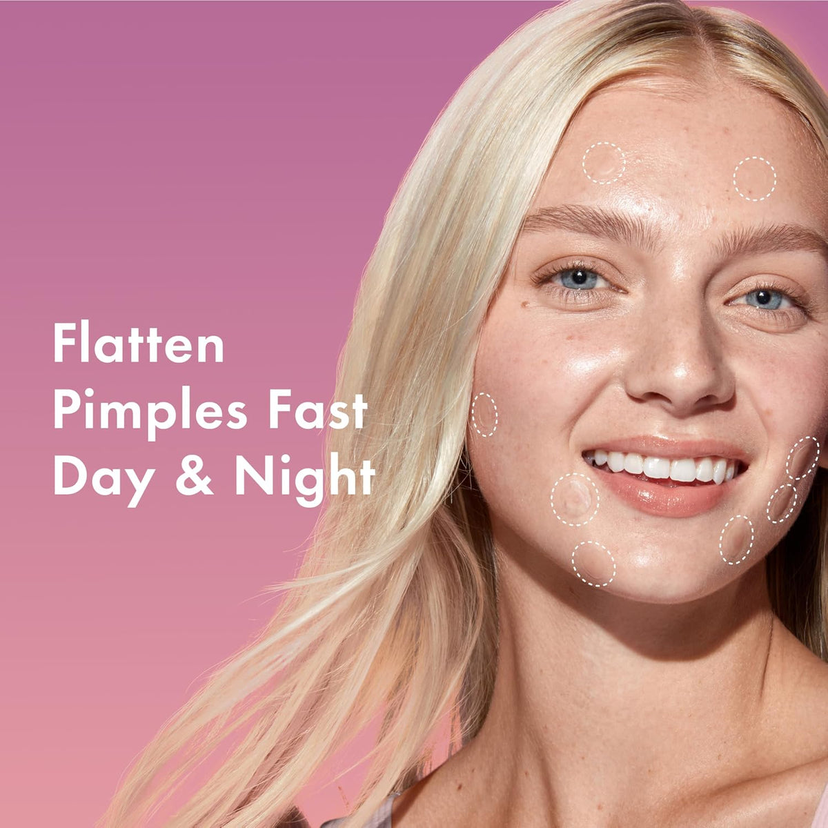 Rael Overnight Spot Cover contoured blemish patches designed for extra adhesion during sleep