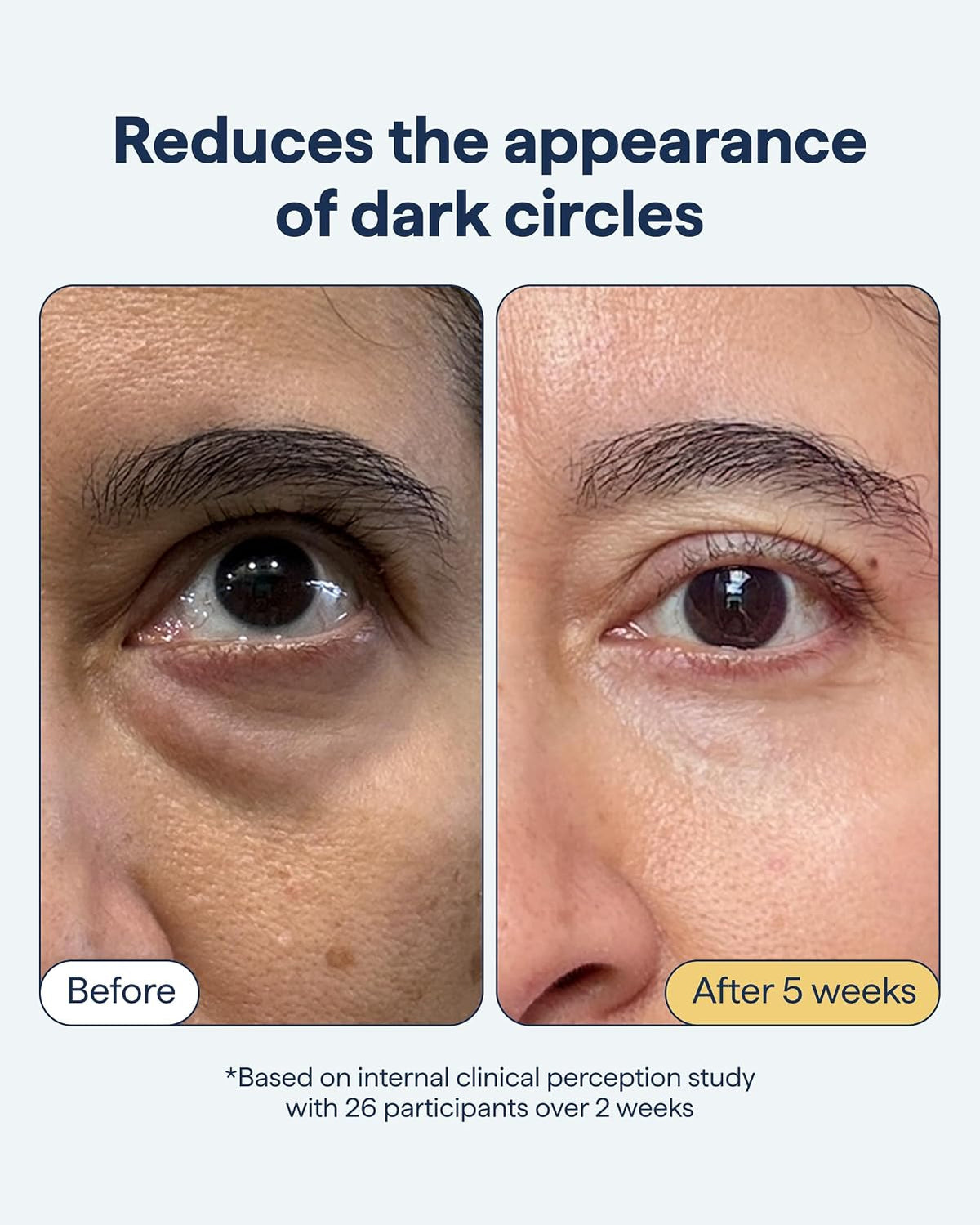 Dermatologist formulated caffeine and kojic acid eye cream packaging texture