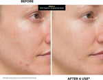 Premium imported brightening facial mask treatment for reducing wrinkles and sun damage