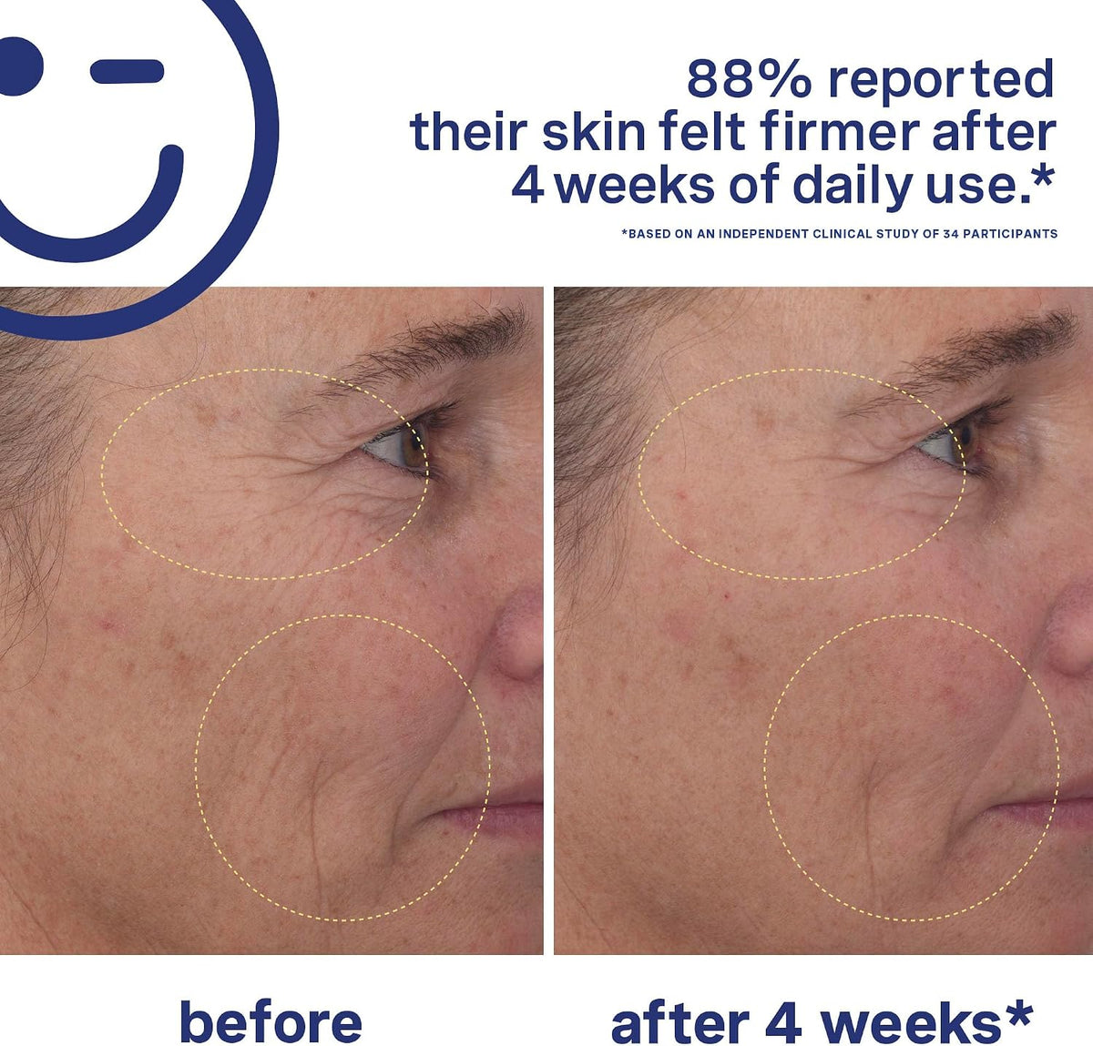 Kate Somerville sulfur face wash and retinal serum set for clear skin