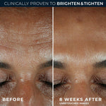 Close up view of the RoC Vitamin C Serum packaging detailing the ten percent active blend and clinical efficacy results.