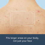 Authentic USA imported Rael acne patch bundle kit for targeted blemish care