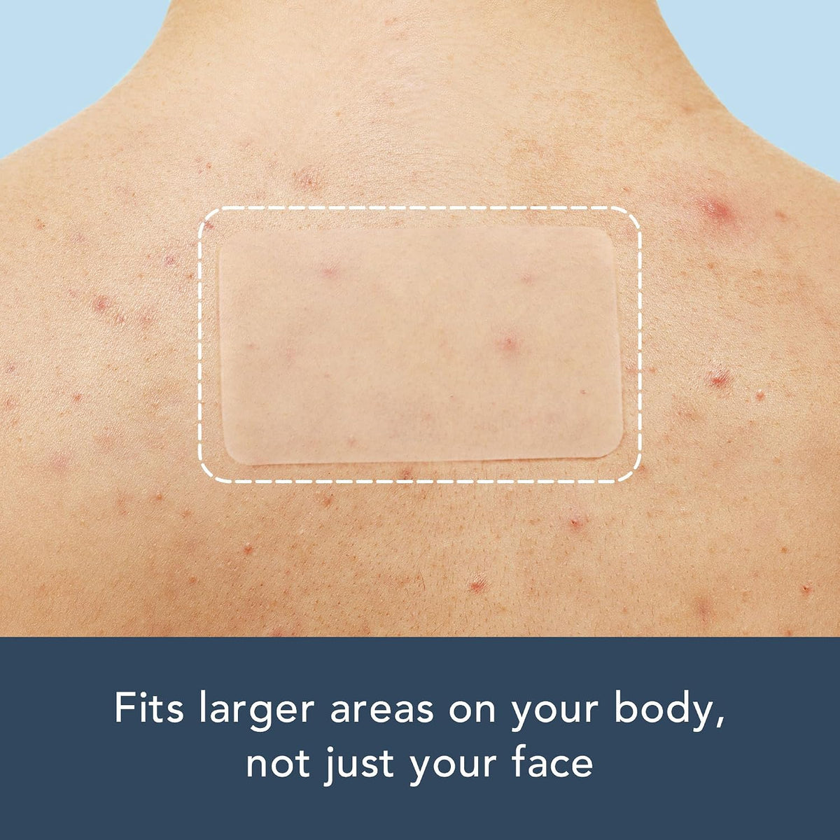 Authentic USA imported Rael acne patch bundle kit for targeted blemish care