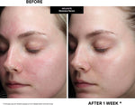 Kate Somerville luxury daily skincare routine hydrating treatment bottle