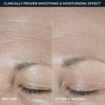 RoC USA imported hyaluronic acid face cream for sensitive skin