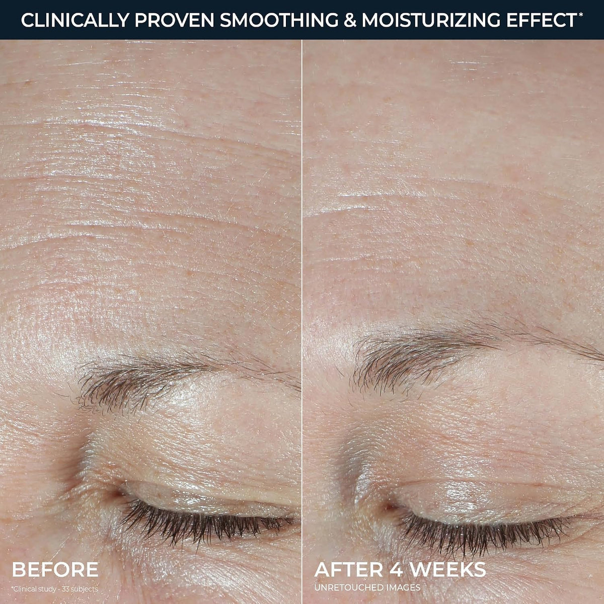 RoC USA imported hyaluronic acid face cream for sensitive skin
