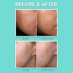 Bliss Clear Genius Overnight Liquid Peel bottle for nighttime skin resurfacing.