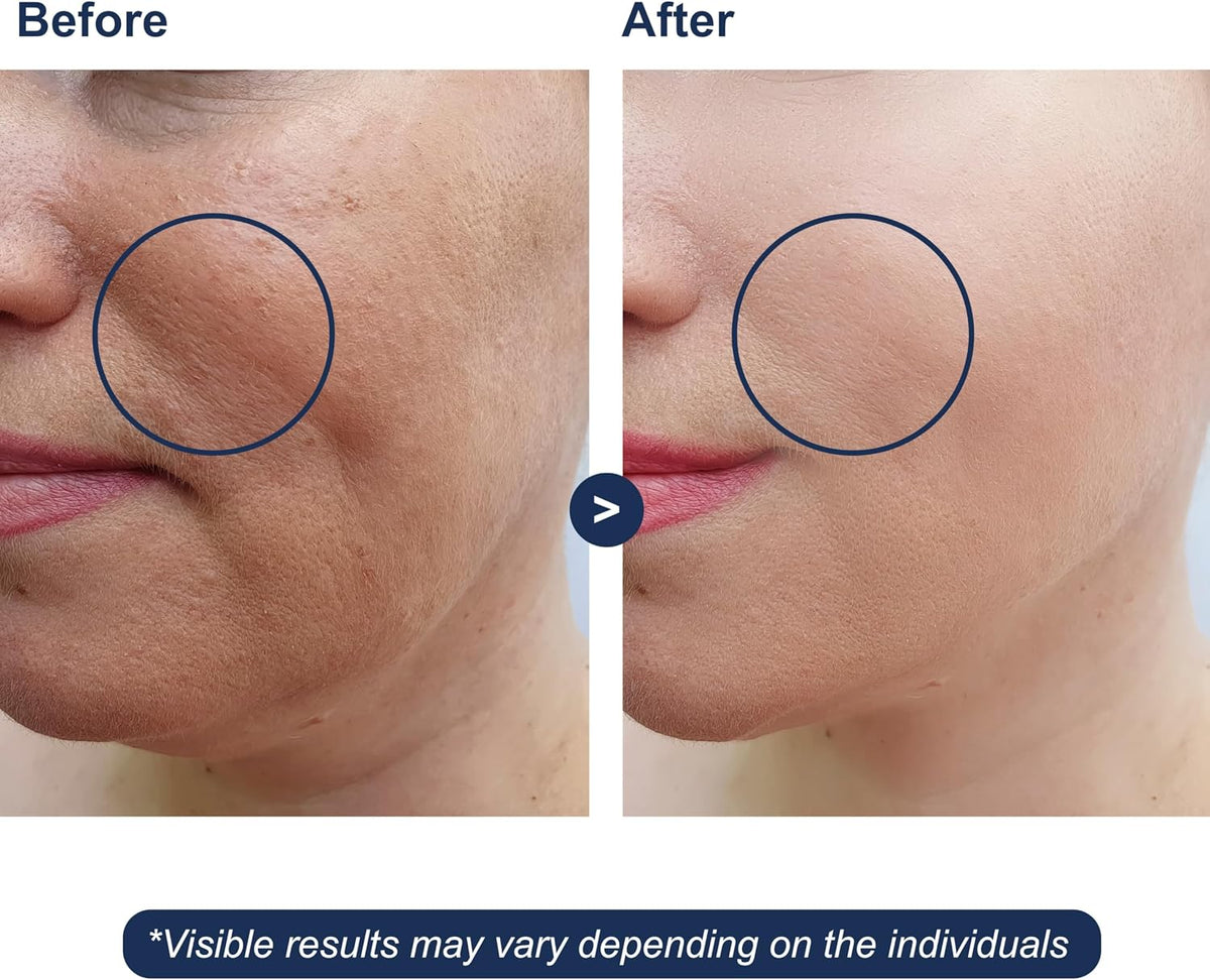 Micro Ingredients skincare serum dropper bottle close up