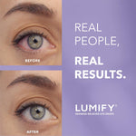LUMIFY eye drops bottle for red eye relief