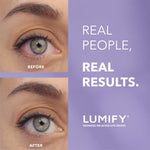 LUMIFY 0.17 fluid ounce sterile ophthalmic solution bottle