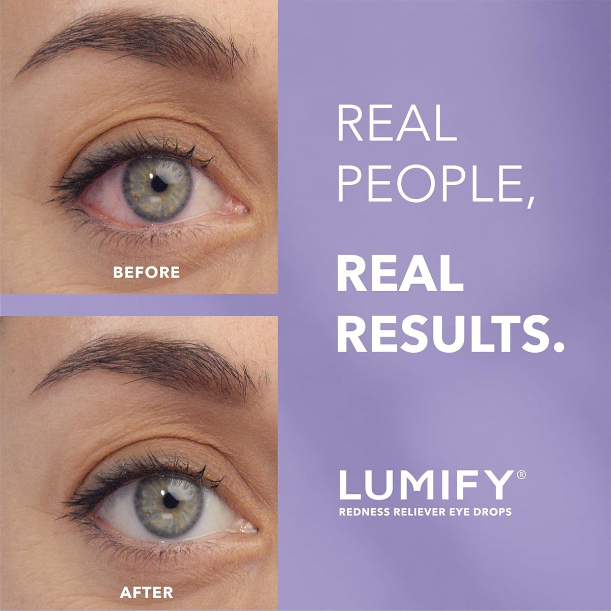 LUMIFY 0.17 fluid ounce sterile ophthalmic solution bottle