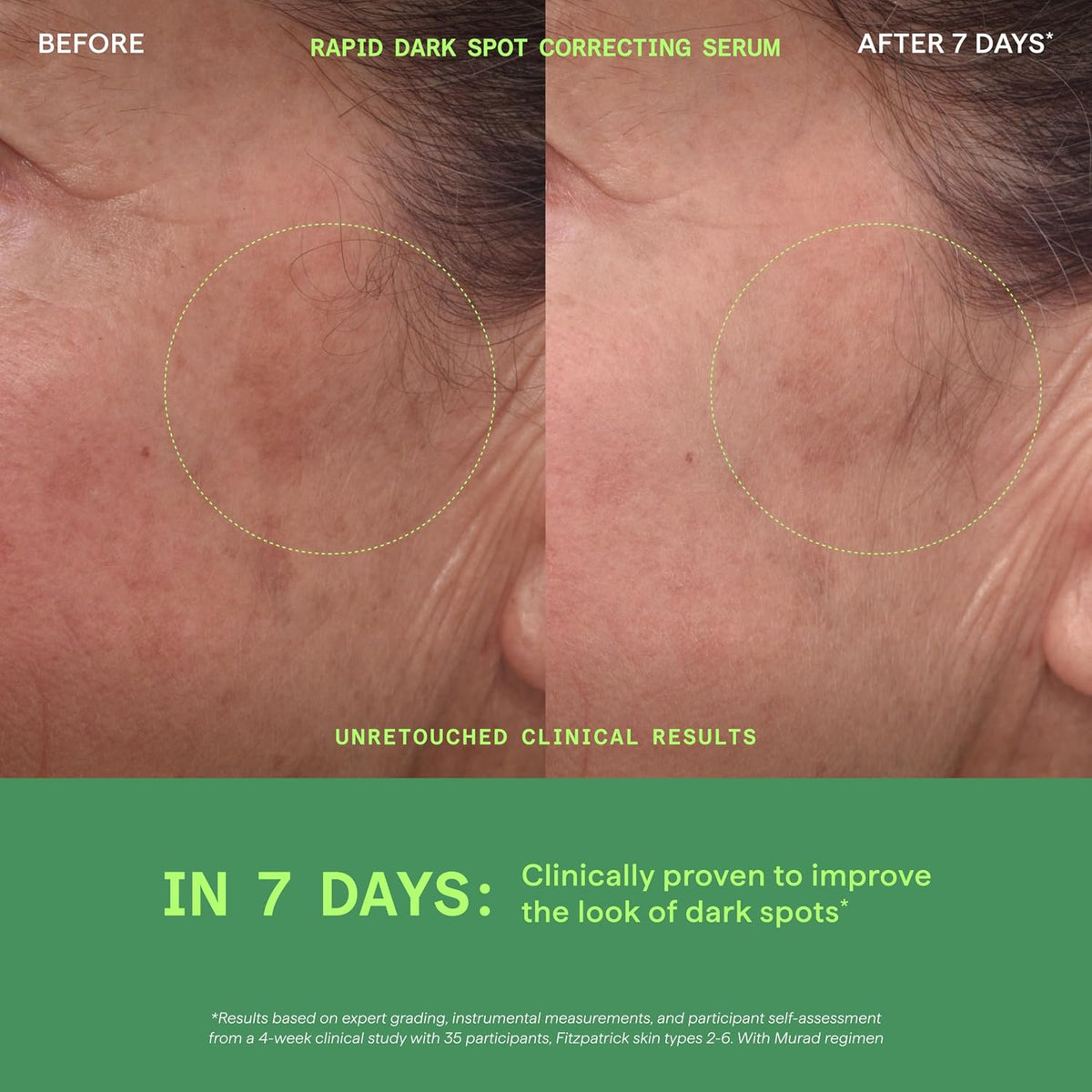 Murad retinol youth renewal serum and dark spot correcting serum bottles