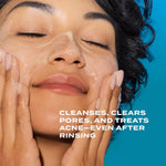 Murad salicylic acid acne treatment bundle application step