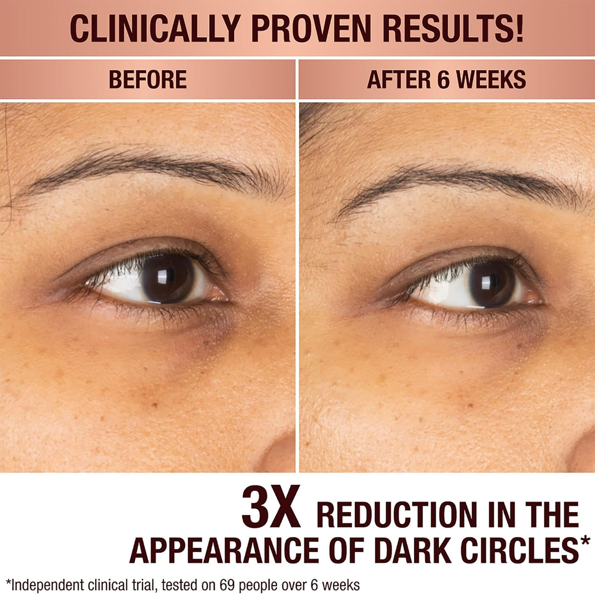Applying Charlotte Tilbury brightening serum to under eye area