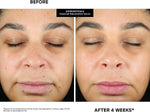 Kate Somerville KateCeuticals(R) SuperCell - Rejuvenation Peptide Serum to Repair Damaged Skin and Reduce Fine Lines and Wrinkles, 1 Fl Oz - Image 11