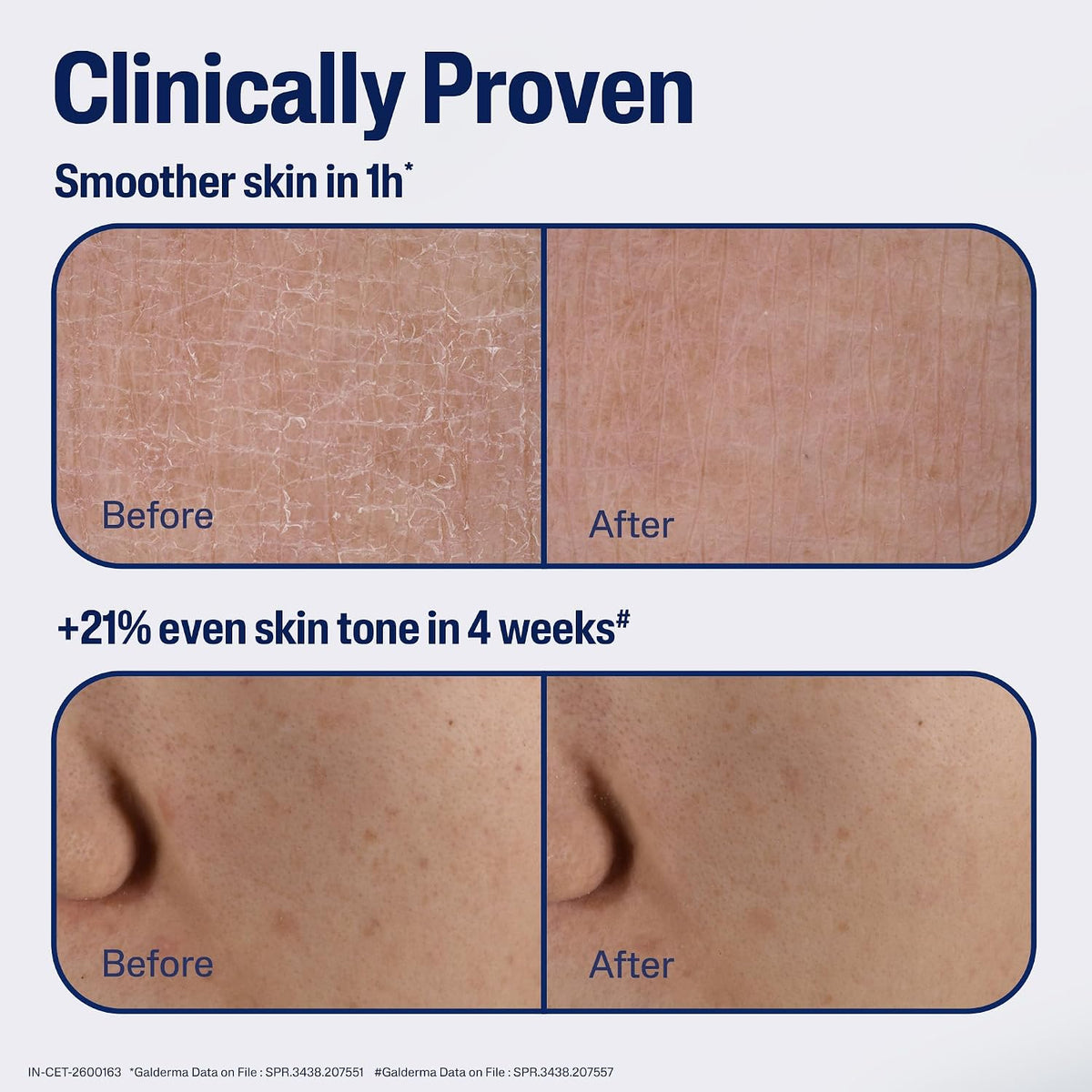 Cetaphil Advanced Recovery Serum dropper and texture preview