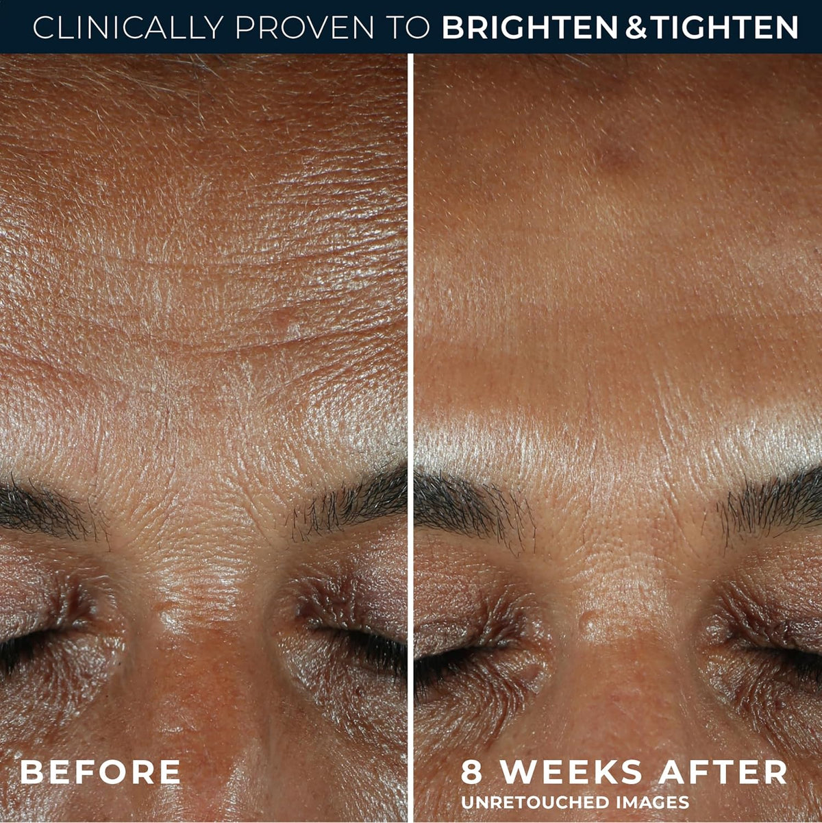 Close up of RoC brightening serum label details