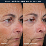 RoC non invasive anti wrinkle treatment pads showing step instructions on the side packaging