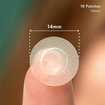 Close up view of Rael hydrocolloid pimple patches with dissolving microcrystals for blind pimples.