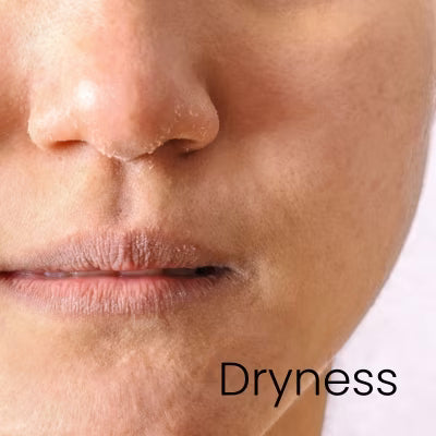 The Ordinary Dryness