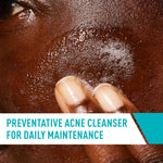 CeraVe Acne Control Cleanser - preventative acne cleanser for daily maintenance