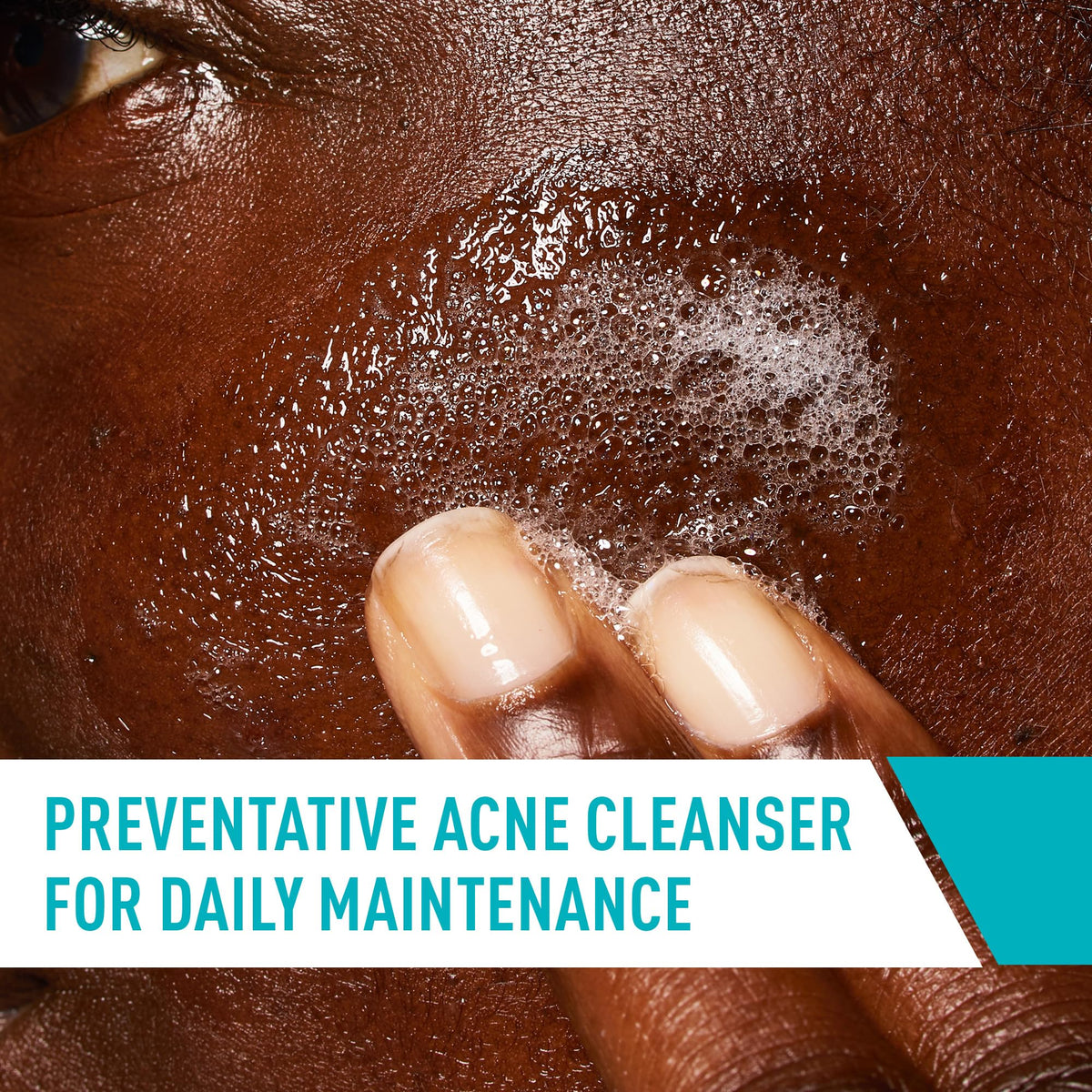 CeraVe Acne Control Cleanser - preventative acne cleanser for daily maintenance