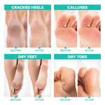 Aloe vera infused foot peeling booties for cracked heel repair