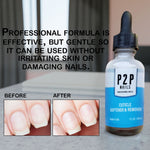 Professional P2P Nails cuticle care treatment bottle