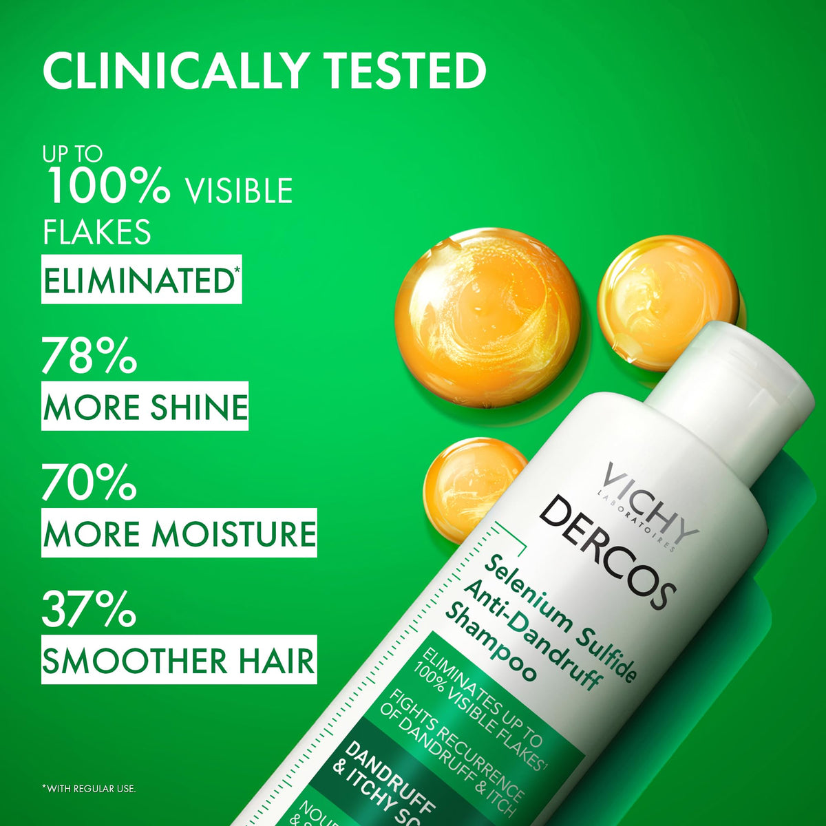 Vichy anti-dandruff hair treatment bottle showing fluid ounce measurement