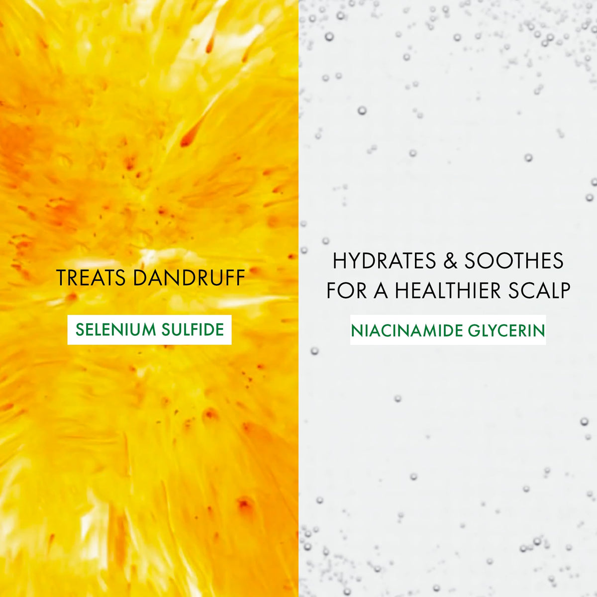 Dermatologist recommended selenium sulfide shampoo for dry flaky scalp