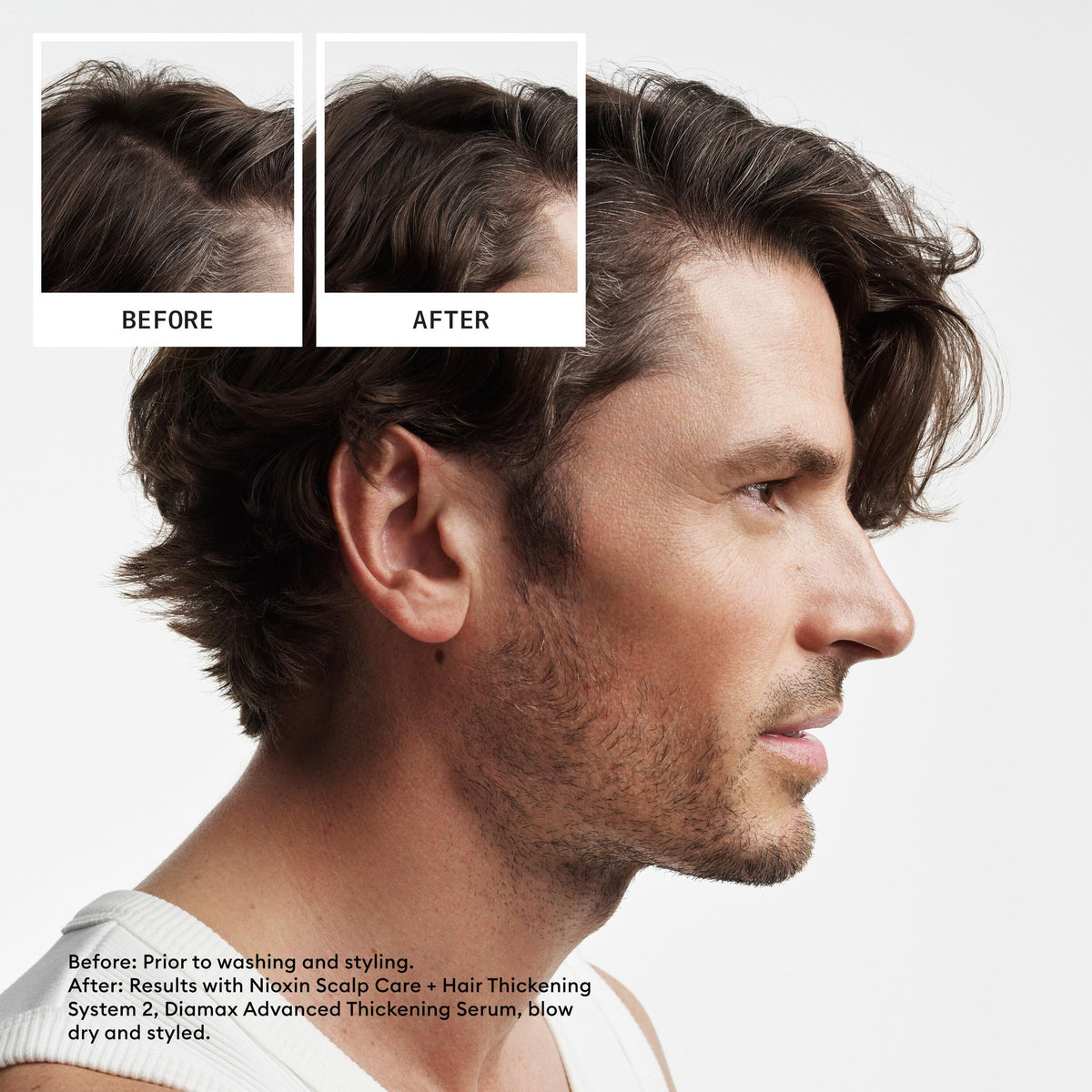 Nioxin System 2 Cleanser Shampoo professional 300ml bottle showing product benefits and volume details.