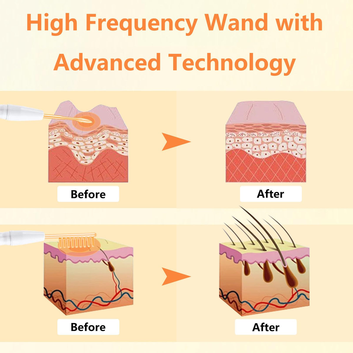 Portable high frequency machine electrodes and device