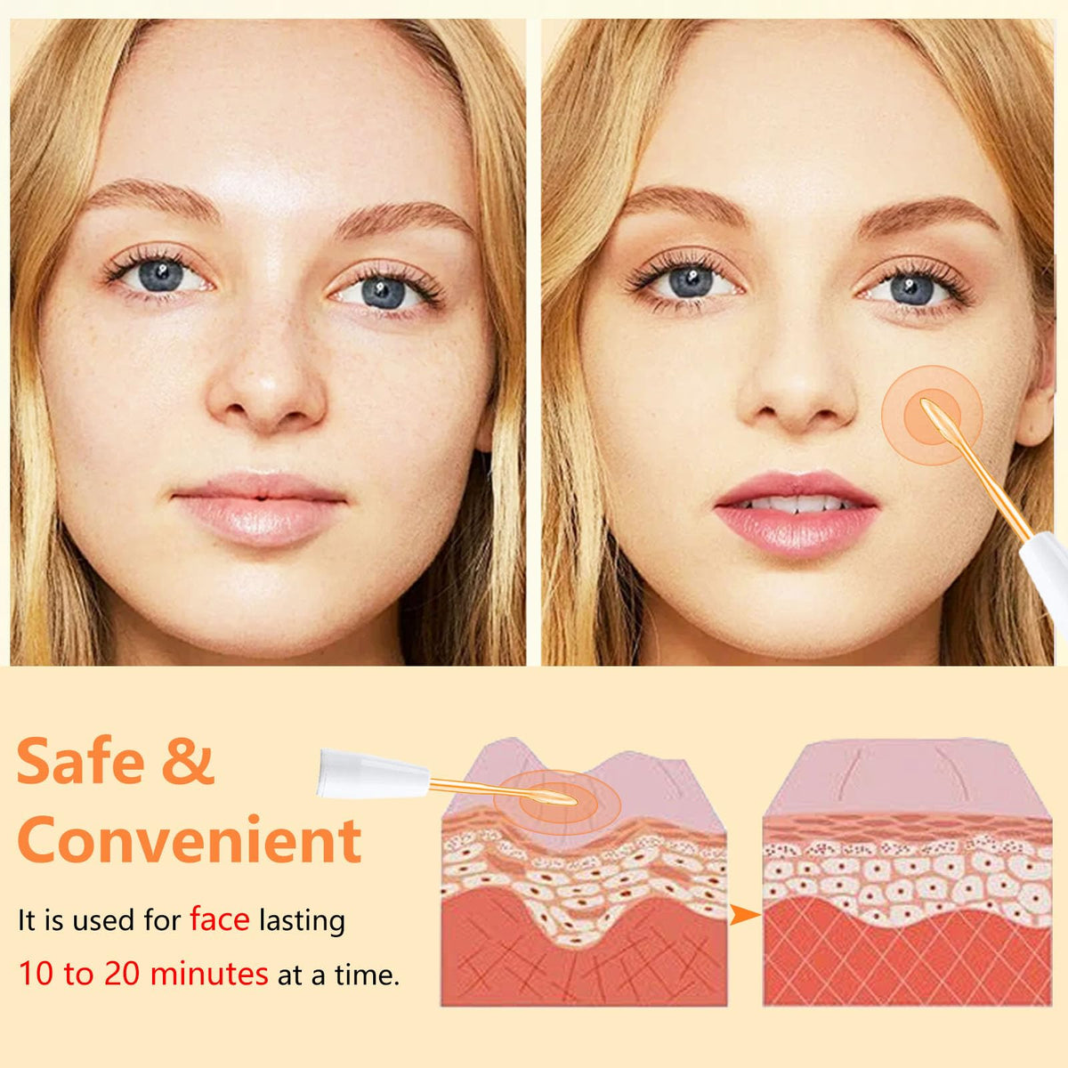 R A Products facial machine for skin tightening