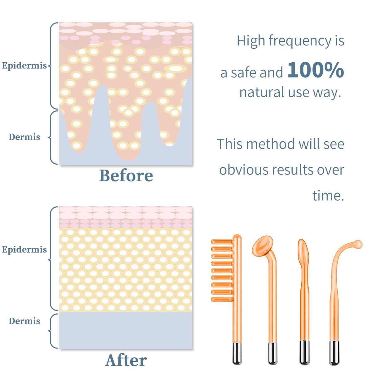 High frequency facial wand mushroom tube for face tightening