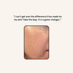 Close up view of the safety tip on the stainless steel dermaplaning blade