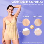 Side profile of Taksome laser hair removal tool