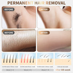 Gransumr painless IPL hair remover showing the digital flash counter screen and sleek ergonomic handle.