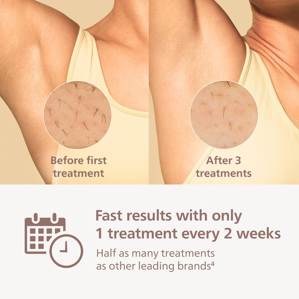 Hand holding Philips Lumea 7000 device