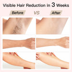 BoSidin hair removal system in retail packaging