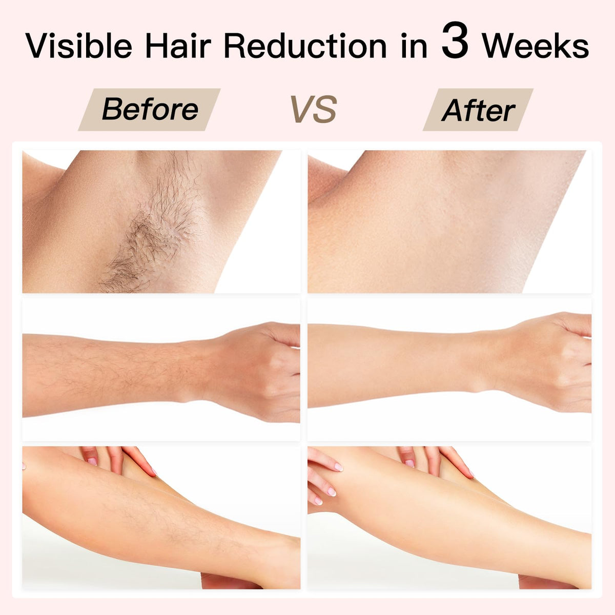 BoSidin hair removal system in retail packaging