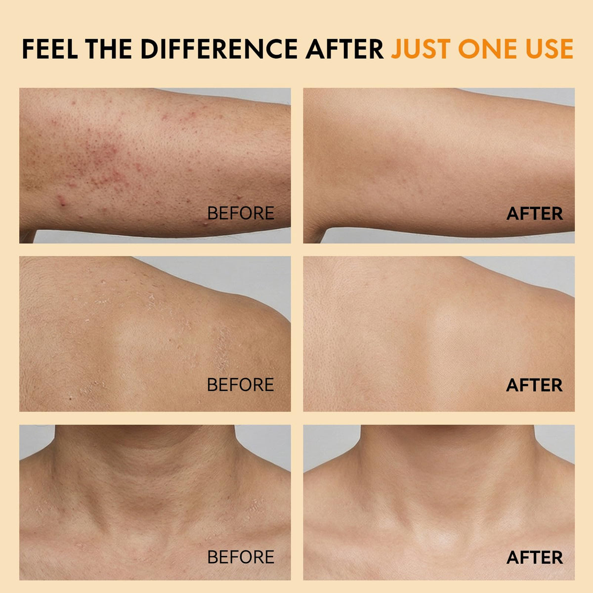 Eelhoe skin smoothing spray package contents featuring the dual-textured physical exfoliation sponge