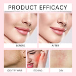 Side profile of Arstech dermaplaning spray highlighting fine peach fuzz on the skin surface.