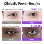 Numbuzin anti aging under eye treatment box with ingredients list displayed