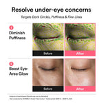 Abib retinal anti-aging eye patches applied to forehead lines