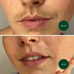 Nads wax strips included calming oil wipes and skin shield powder
