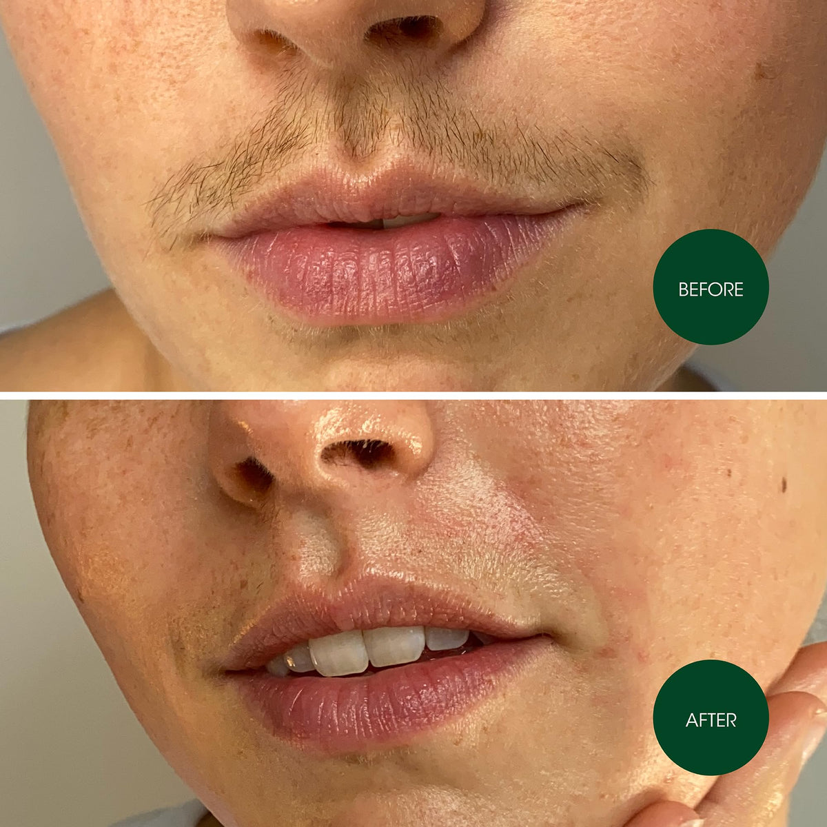 Nads wax strips included calming oil wipes and skin shield powder