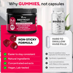 VitaUp Beet Root Gummies dietary supplement bottle in professional lighting